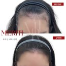 정헤어라인 - 26898 | 정헤어라인