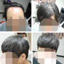모위드헤어