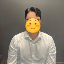 용의원 | [모발이식 1년 후기] 강남 용닥터의원 _ 2,500모 비절개 (내돈내산 찐후기)