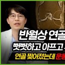 무릎십자인대 & 반월상 연골판 확인하기(221108) 이미지