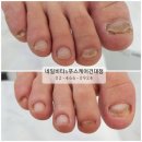 [건대 발톱무좀] 네일비타&푸스케어 건대점 재방문 후기!