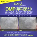 다나두피 이미지