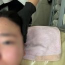 시나뷰티 | 전주 여드름관리 시나뷰티 세멘아크네 후기