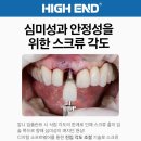 마이크로치과기공소 네이버블로그