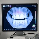 초민의원 | 잇몸이 보내는 SOS! 급찐치통에 인생 조졌다 썰 푼다