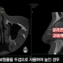 미플러스성형외과의원 네이버블로그