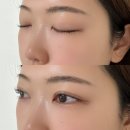 아리솜 이미지