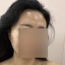 위례 피부관리샵 추천 올가드림뷰티 송파위례점 리얼후기