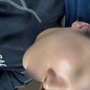 엘랑에스테틱 | 마산 여드름 관리 조엘랑더마랩 에스테틱 후기