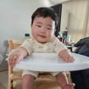 부산 7개월 아기 소아사경 치료일지 부산성모병원 재활의학과