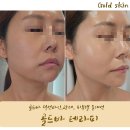 골드스킨&바디 이미지