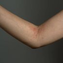 둔산한의원 이미지