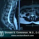 Understanding an MRI of the Normal Lumbar Spine 이미지