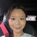 현한의원 | 안면비대칭교정 가격 | 안면비대칭한의원 교정 후기