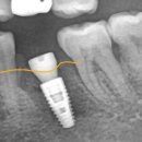 물금센트럴치과의원 이미지