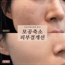 미(美)스킨앤바디 - 의정부시 | 대전 대덕구 송촌동 피부관리 추천 온율스킨앤바디 (구 다경미) 트로이필 관리