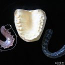 행복한치과의원 네이버블로그