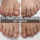 문제성 손발톱 전문관리 케어톱톱