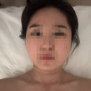 미케어 | 신풍역에스테틱 미엠아이에스테틱 웨딩케어 후기