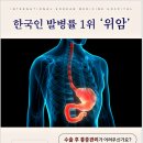 인천고주파 이미지