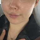 샘아쿠아라인 | 서울대 출신 피부과 전문의가 있는 청담피부과 추천