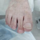 발톱 고민이 많을땐 의정부 문제성 발톱 레푸스 앤 두두뷰티