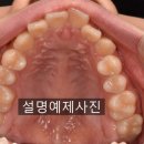 웃는E치과교정과치과의원 네이버블로그