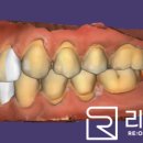 STL치과기공소 이미지