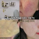 토앤레더스페이스 | 영통 인계동 주근깨&amp;잡티제거 미작뷰티에서 피부관리