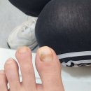 디에고푸스 구의점 초롱쌀롱 이미지