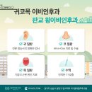 소리코이비인후과 이미지