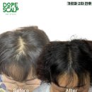 돕스칼프 이미지