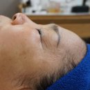 수성구피부관리/대구슈렉필/뉴욕비비에서 17만원상당의 물방울리프팅과 걸그룹윤곽관리 후기