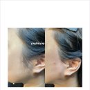 (주)인앤인디자인 | 수원왁싱 인앤인왁싱, 매끈 피부 위한 현명한 선택과 관리 팁