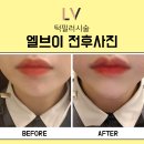 엘브이의원 이미지