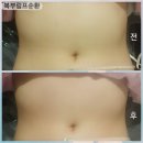 봉선1로 | 광주) 올가드림뷰티 봉선점 복부 림프 &amp; 디톡스 관리 후기