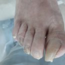 의정부무좀, 발톱무좀 관리받기 위해 방문하게 된 레푸스 앤 두두뷰티 호원점