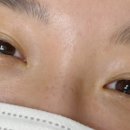 속눈썹바이진