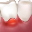 탑티어치과의원 이미지