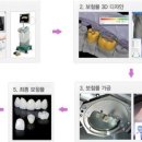 나비치과기공소 네이버블로그