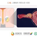 동일진단 이미지