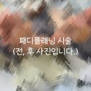 밀리언플래닝 | 진접 패디플래닝 발각질 잘하는곳 수포형 무좀발 악건성 남성발각질