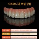 스마일100치과의원 네이버블로그