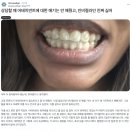 에이피덴탈랩치과기공소 | [그래피 설명회 시리즈 1편] 소비자 편 '그래피 SMA'를 선택할 수밖에 없는 이유
