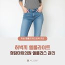청담마이의원 | 하체비만 허벅지 셀룰라이트 관계와 해결법
