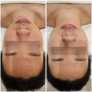 한국지엠첨단바로서비스 | 첨단 맞춤형 피부관리 도하담에스테틱 문제성피부 찐후기