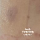 예젤의원 네이버블로그