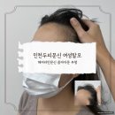 새벌로 | 인천두피문신 여성탈모 헤어라인문신 콤마더문 부평