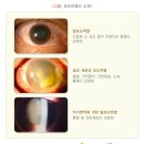 아이윤안과병원 이미지