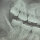 바른윤치과의원 이미지
